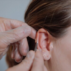 Auriculoterapia - tratamiento en la oreja